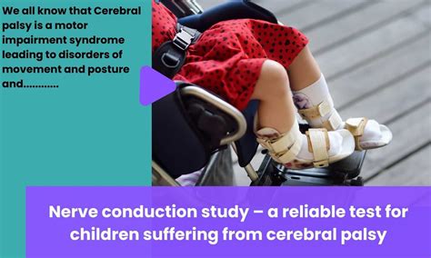 Journal Club: Nerve conduction study-a reliable test for children ...