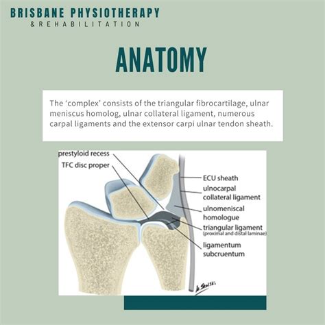 TFCC Tear - Triangular Fibrocartilage Complex - Symptoms, Treatment ...