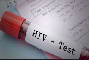 Scientists develop paper-based test for early detection of HIV
