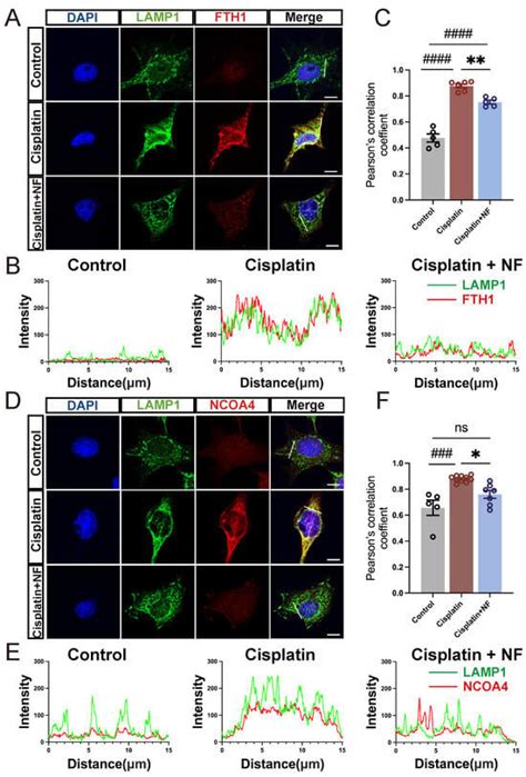 Nuciferine Protects Cochlear Hair Cells from Ferroptosis through ...