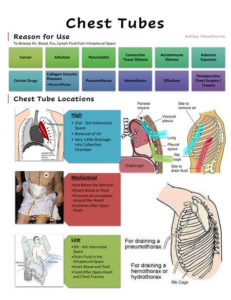 What Is The Medical Definition Of A Chest Tube at Robin Walker blog