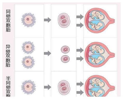 世界上最大肚子的孕妇，本以为怀了双胞胎，检查发现肚里有11个！