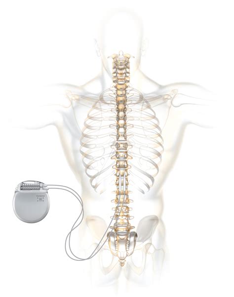 Stimulator For Back Pain