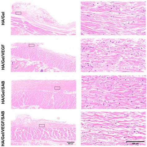 Injectable Hydrogels Based on Hyaluronic Acid and Gelatin Combined with ...