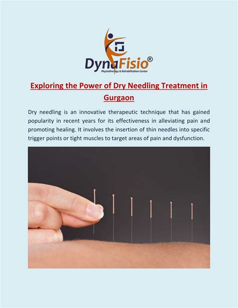 PPT - Exploring the Power of Dry Needling Treatment in Gurgaon PowerPoint Presentation - ID:12346823