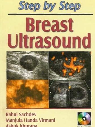 Buy Step by Step:Breast Ultrasound Book Online at Low Prices in India ...