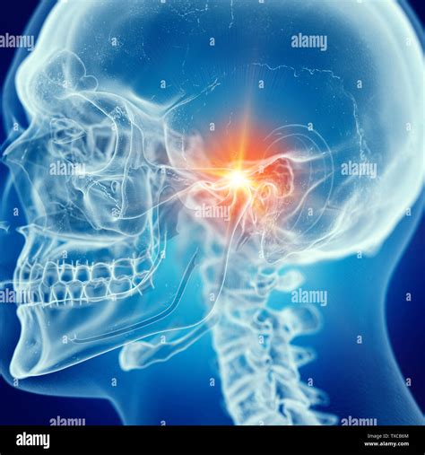 Temporomandibular joint hi-res stock photography and images - Alamy