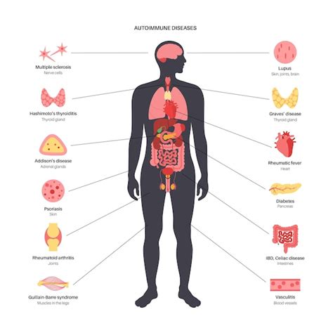 Autoimmunity 的图像结果