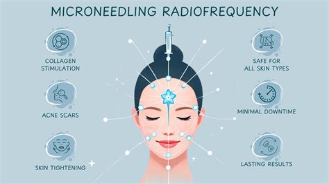 Microneedling Radiofrequency: The Revolutionary Skin Rejuvenation Treatment