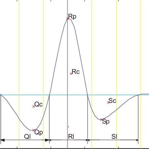Image result for PVC Localization Chart