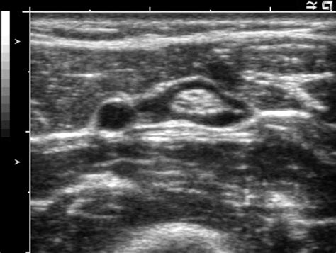 Local Anesthesia Blocks 的图像结果