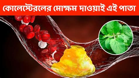High Cholesterol Control Leaf: বাপ বাপ বলে পালাবে শরীরের উচ্চ ...