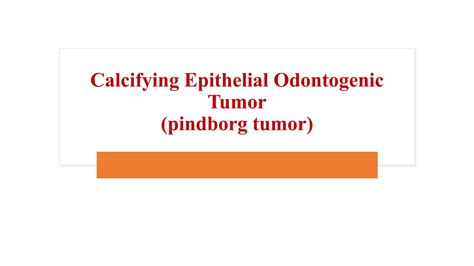 Adenomatoid odontogenic tumor, calcifying epithelial odontogenic tumors and calcifying ...