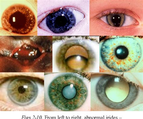 Image result for Iris Recognition Using MATLAB Source Code