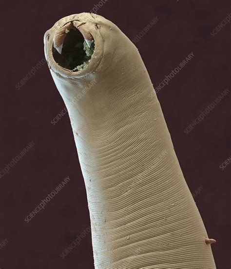 Hookworm, SEM - Stock Image - C011/5005 - Science Photo Library