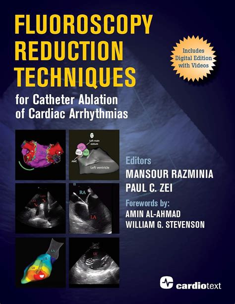 Fluoroscopy Reduction Techniques for Catheter Ablation of Cardiac ...