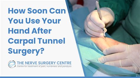How Soon Can You Use Your Hand After Carpal Tunnel Surgery? - The Nerve ...