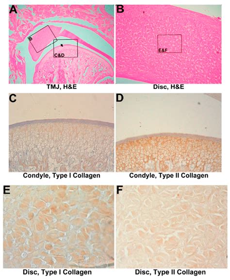 Histological and Immunohistochemical Analyses of Repair of the Disc in ...