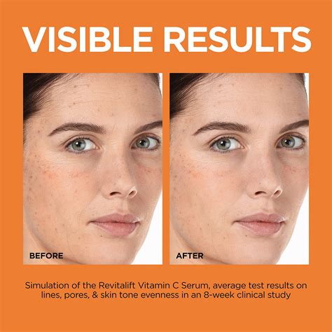 いろいろ vitamin c serum before and after photos 109717-Vitamin c serum ...