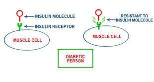 'Diabetes can be reversed' | TheHealthSite.com