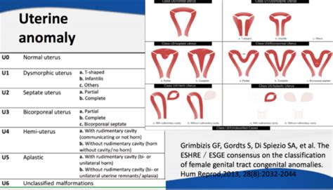 Image result for Female Reproductive System Disorders