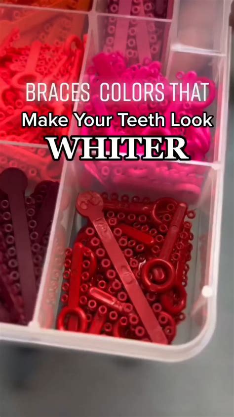 Worst braces colour! | Braces colors, Sensitive teeth, Teeth whitening