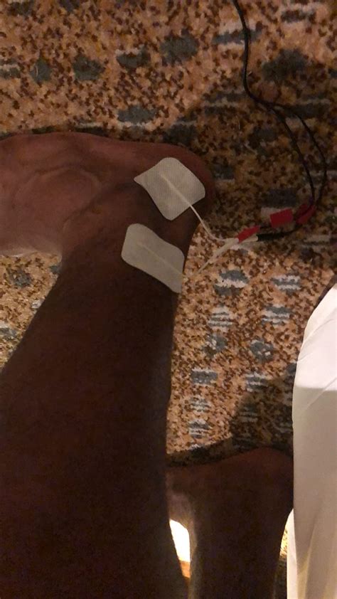 UltraCare PRO Self Adhesive Electrode Pads for EMS, TENS, IFT and Pulse ...