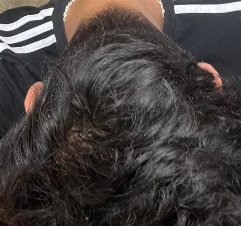 18M wavy haired with widows peak and have a fast growing hair am i balding or paranoid af? : r ...