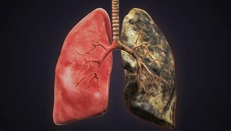 How to Remove Cigarette Tar from Lungs & Body Naturally | Healeo Nutrition