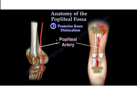 Popliteal Fossa Popliteal Artery Entrapment Syndrome: Role Of Imaging