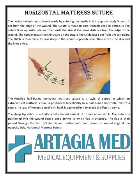 Horizontal And Vertical Mattress Suture at Eula Seay blog