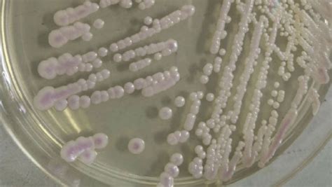 美国爆发“超级真菌”疫情，感染者无法治愈，这是什么真菌？_腾讯新闻