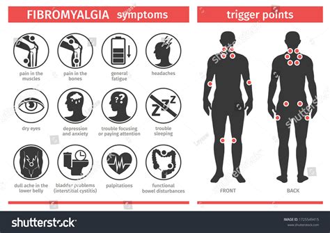 Fibromyalgia Tender Points