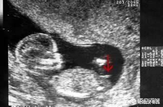 怀孕十二周可以从B超中的小肿块分辨男女，这真的可以看出来吗？|胎儿|肿块|男孩_新浪新闻