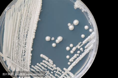 希尔博士讲堂 | 细胞污染大展观 - 真菌篇-逍鹏生物官网