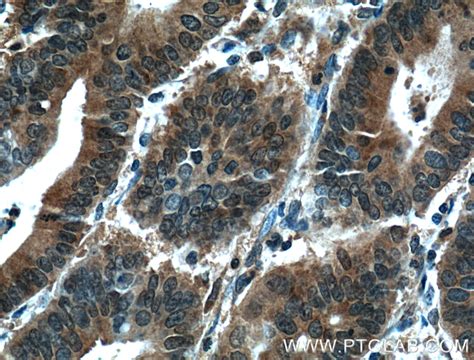 STAT3 antibody (60199-1-Ig) | Proteintech