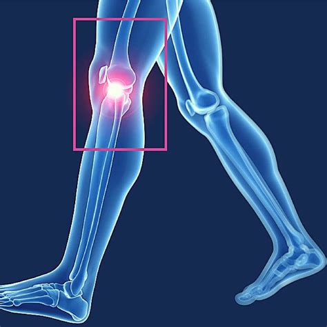 Arthogram – Spring Hill MRI and Imaging
