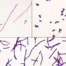 Bacteria Types Slide, Separate Smears, Gram Stain | Carolina Biological ...