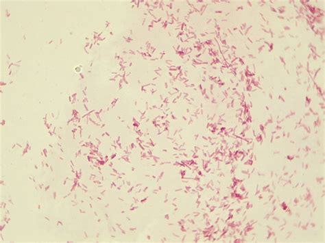 E Coli Gram Stain E Coli Appearing To Be Cocci? : R/microbiology