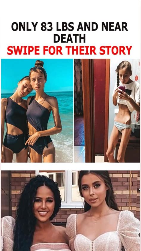 They Weighed Just 83 lbs and Nearly Died But They Overcome!: What Do ...