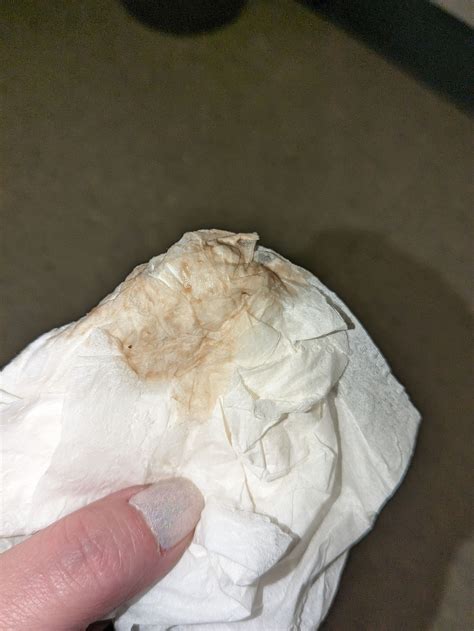 6/7 dpo discharge | BabyCenter