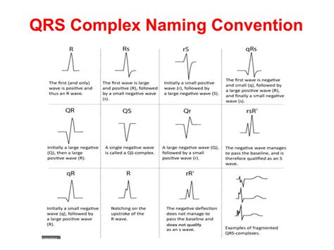 QRS INTERVAL IN ECG AND ITS ABNORMALITIES | PPTX
