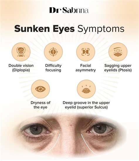 Sunken Eyes: Causes, Symptoms and Prevention - Dr Sabrina™