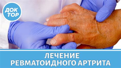 Ревматоидный артрит: лечение, причины, симптомы, диагностика