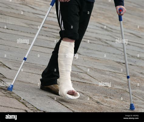 Sprained Ankle Cast Crutches