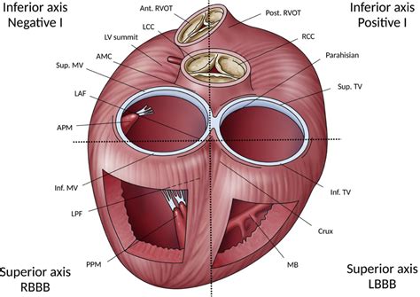 Image result for PVC Localization Cartoon