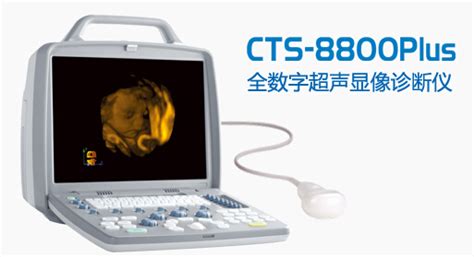 汕头超声便携式三维超声成像诊断仪CTS-8800Plus - 继圣（上海）医疗器械有限公司