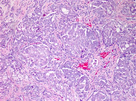 Renal Medulla Histology
