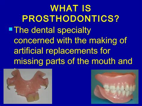 introduction to prosthodontics | PPT