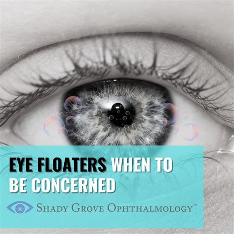 Eye Floaters: When to Be Concerned and What You Should Know - Shady Grove Ophthalmology: Anthony ...